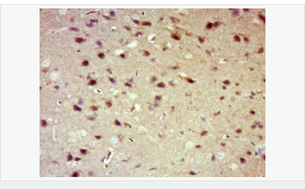 6051b2c71940b.png image.png