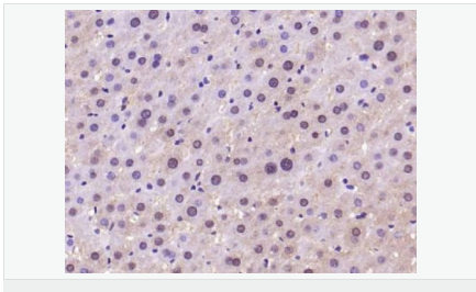 6052aa3e274ef.png image.png