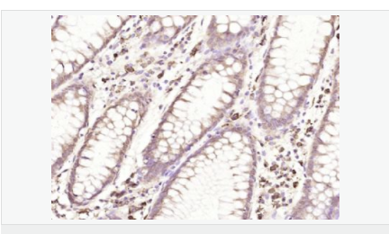 6052c26de65b4.png image.png