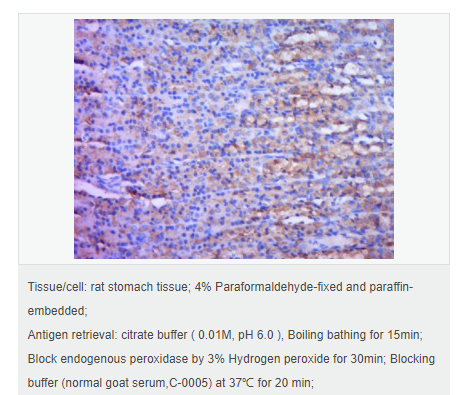 605da196bbffc.png image.png