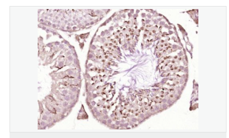 60640f3af070f.png image.png