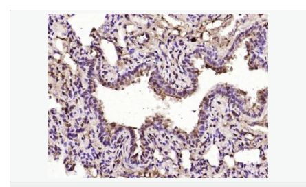 607643e298c62.png image.png