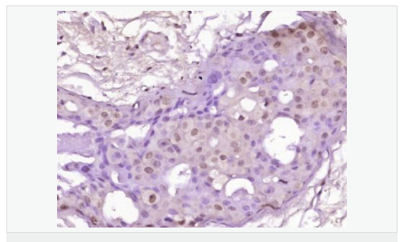 607643f48085d.png image.png