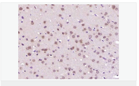 6076493968de7.png image.png